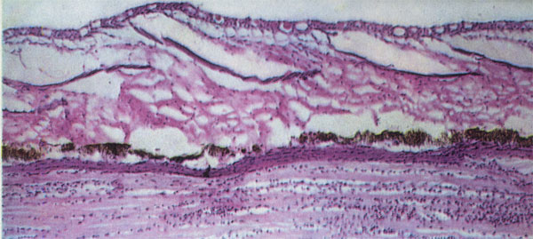 На поперечном разрезе кожи моллинезии виден тонкий наружный слой, покрывающий слои, в которые погружена чешуя. Черные пигментные клетки лежат поверх красноватой мышечной ткани.