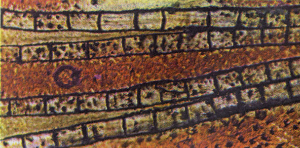 Увеличенные на этой микрофотографии пигментные клетки расцвечивают хвостовой плавник моллинезии красными, желтыми и черными крапинками.